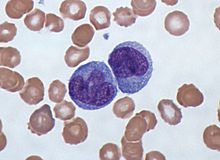 http://upload.wikimedia.org/wikipedia/commons/thumb/e/e6/Monocytes%2C_a_type_of_white_blood_cell_%28Giemsa_stained%29.jpg/220px-Monocytes%2C_a_type_of_white_blood_cell_%28Giemsa_stained%29.jpg